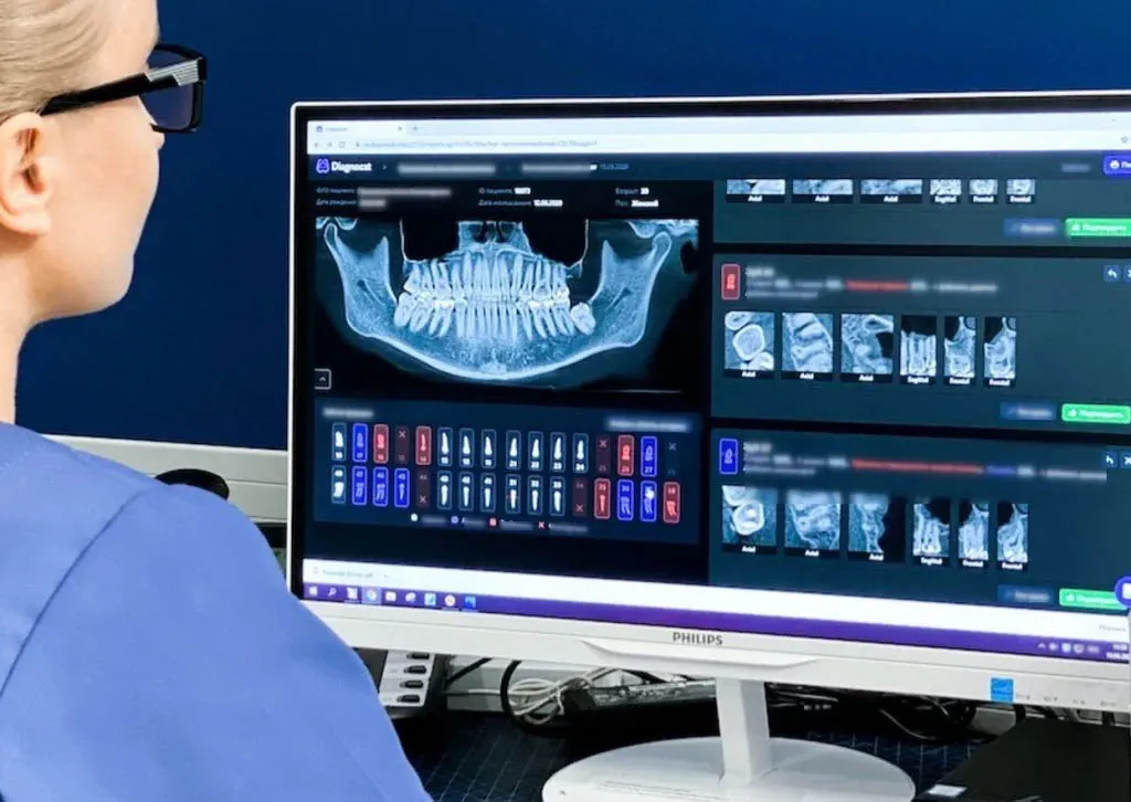 AI X-ray analysis
